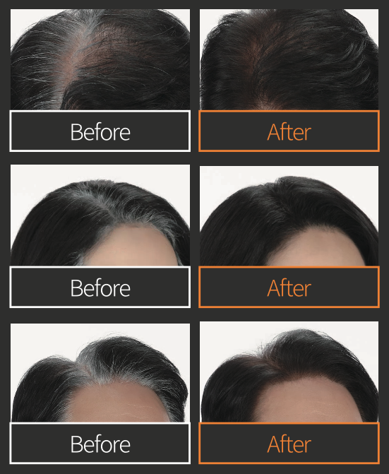 before after images for Cosalooz hair dye